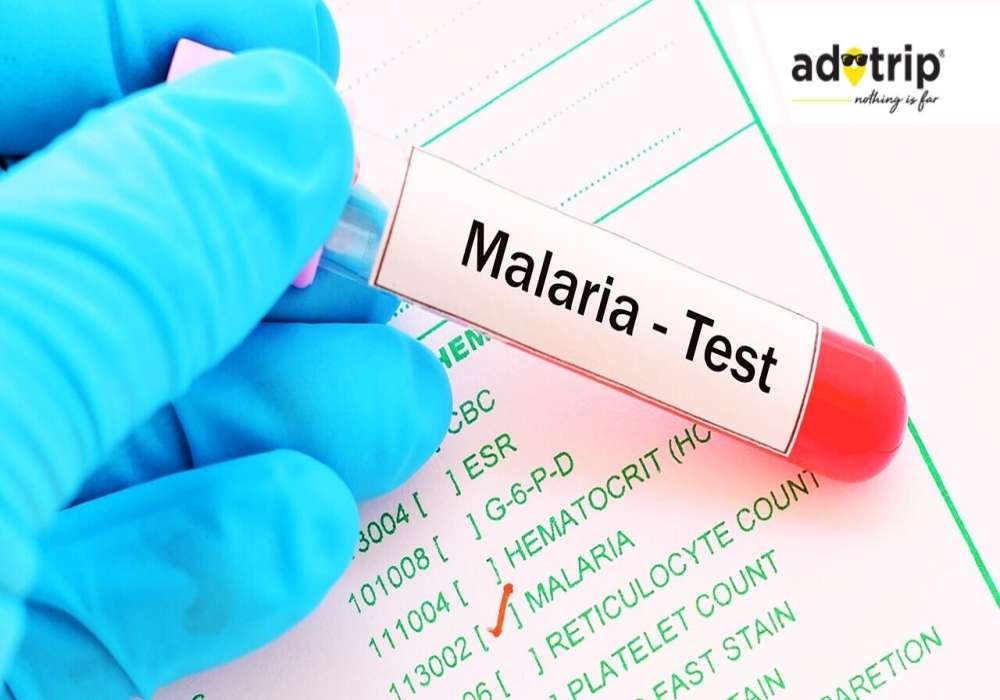 malaria test cost in india, malaria test price in india